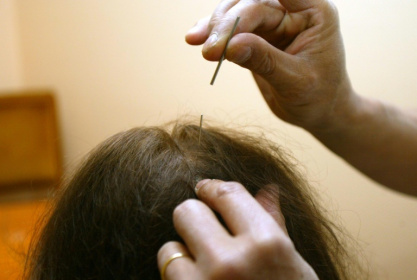 Aromathérapie, acupuncture, réflexologie, ou encore homéopathie, l'existence dans certaines universités de diplômes pour des pratiques de soins non conventionnelles préoccupe des professionnels de santé - JEAN-PIERRE MULLER (AFP)