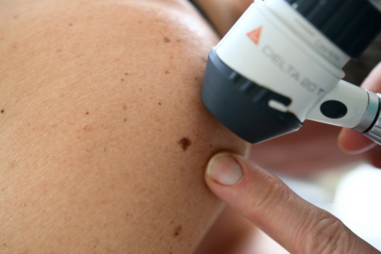 Cancers cutanés : l'Anses alerte sur les risques liés à l'exposition professionnelle aux rayons UV